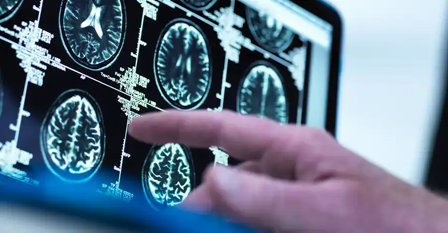 Trauma Solutions: A hand points to a computer screen displaying multiple black and white MRI brain scan images.