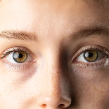 Trauma Solutions: Close-up of a person’s freckled face, focusing on hazel eyes, light eyelashes, and fair skin with soft natural lighting.